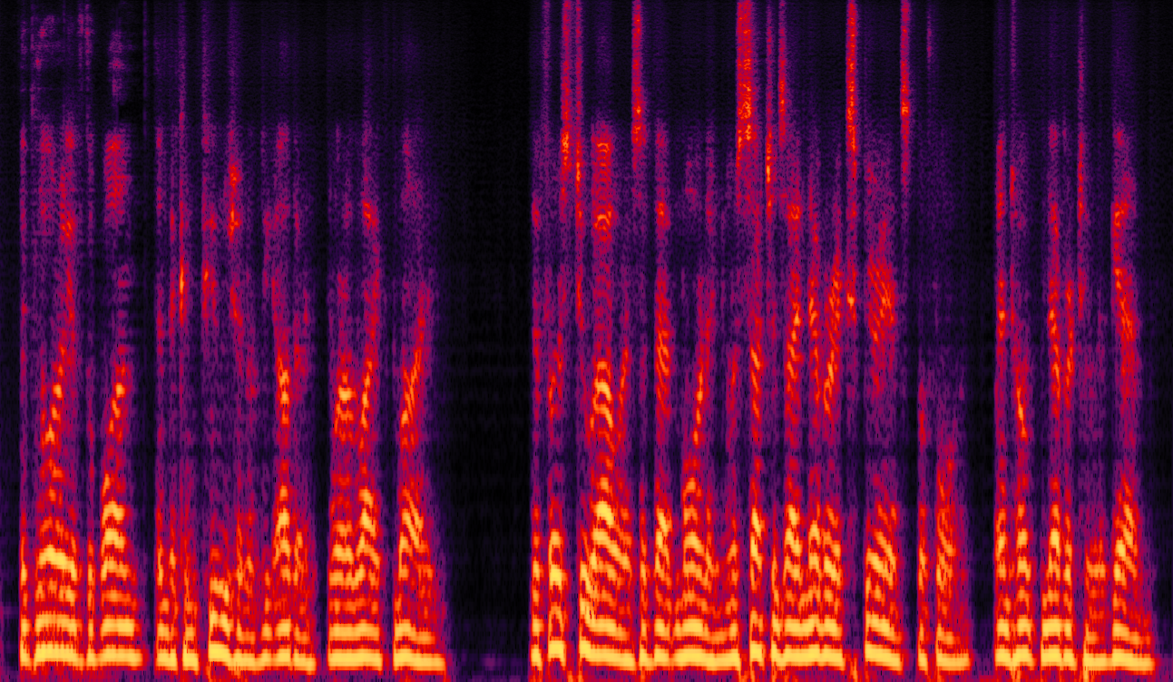 Spectrogram
